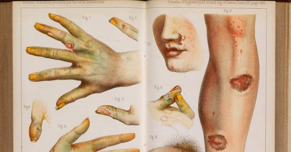 arsenic book – For Reading Addicts